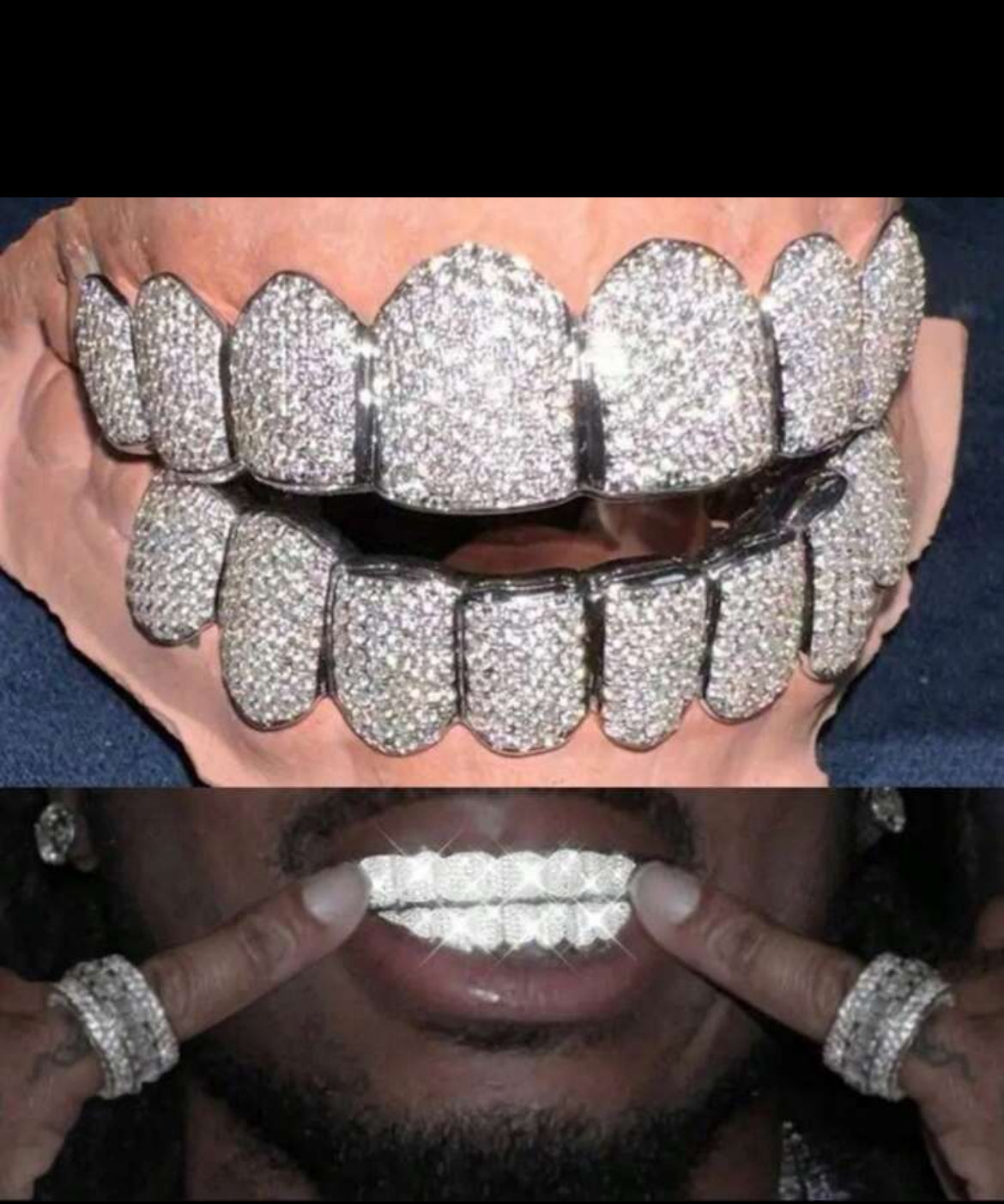 Hot Icy Grillz bottom & top